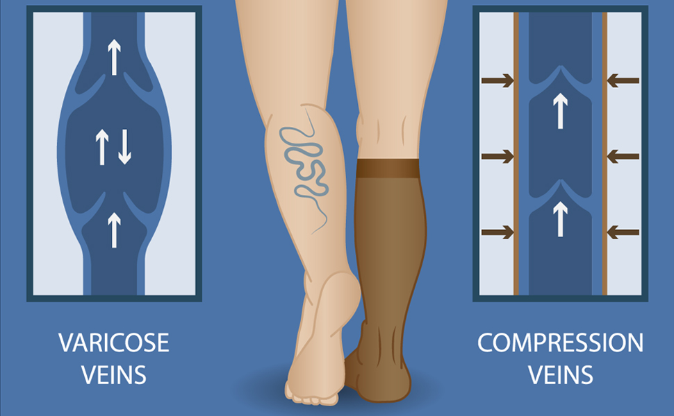 medias de compresion